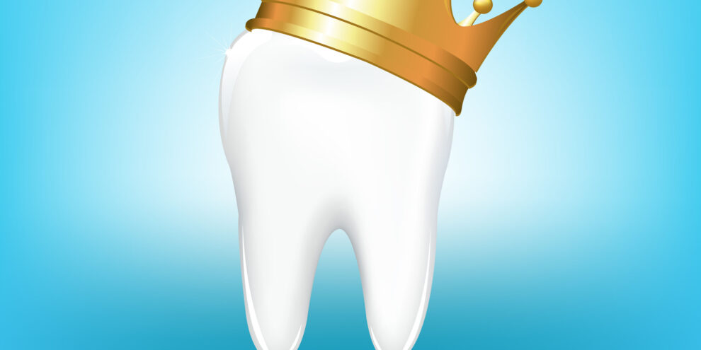 A picture of a tooth with a gold crown on top of it.