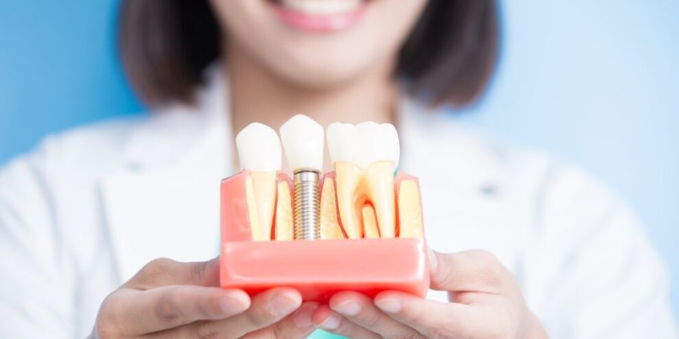 dental implants Duncan, OK