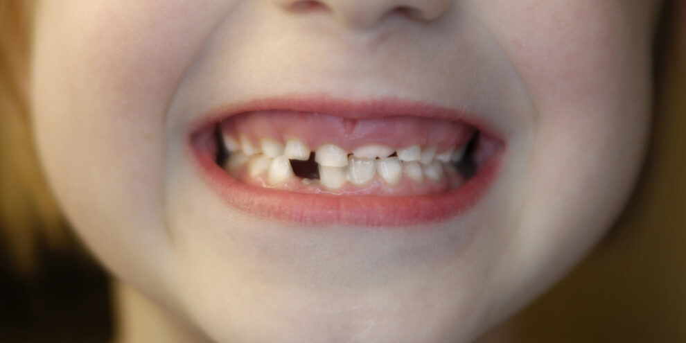 Duncan OK children's dentist