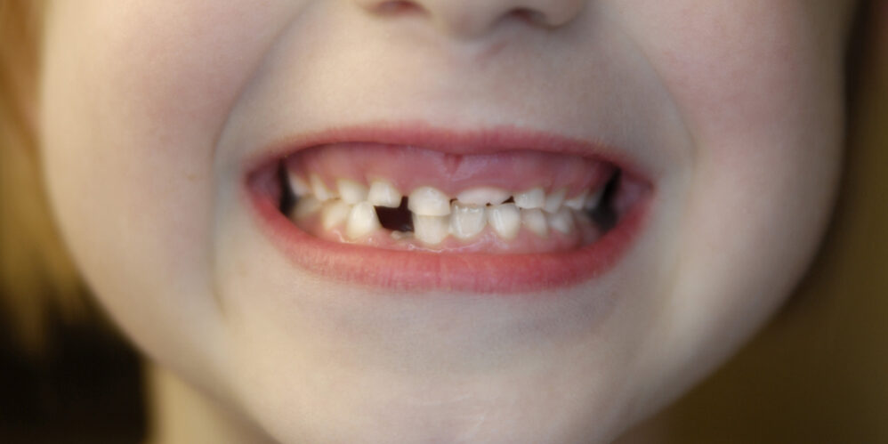 Duncan OK children's dentist
