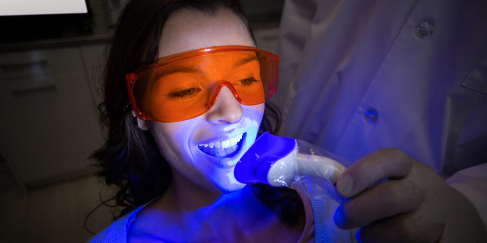 female dental patient undergoing laser dentistry for teeth whitening