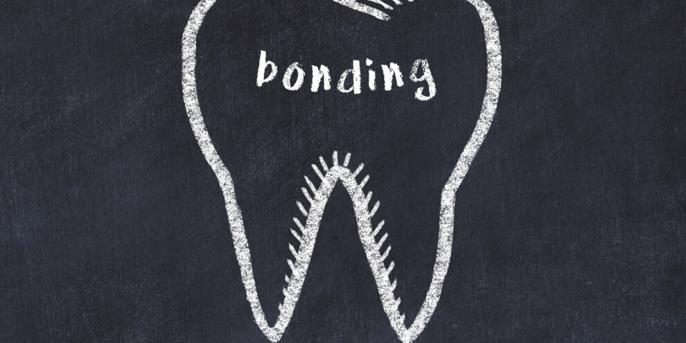 outline of tooth with "bonding" written in the middle on black background