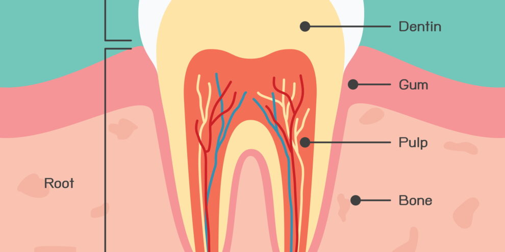 root canal treatment