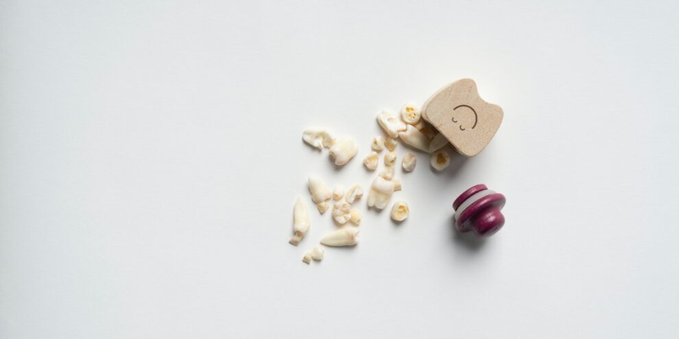 Emergency tooth extraction cost and a box of extracted teeth