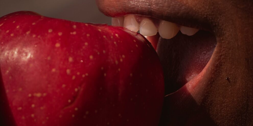 Woman eats a red apple while wearing dental bridges
