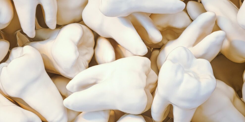 A pile of teeth from a dentist in Duncan, OK