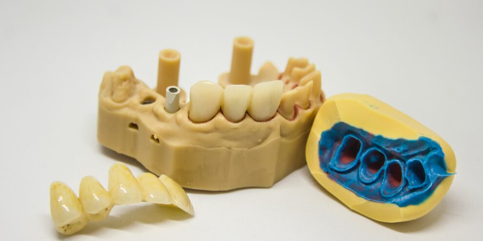 Mold for creating realistic dentures