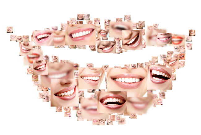 Images of cosmetic dentistry results