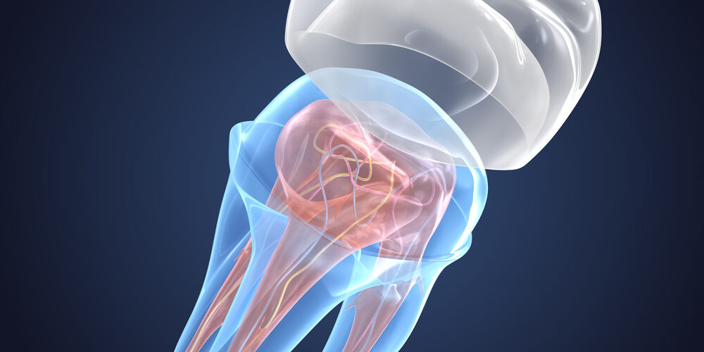 3d image dental crown