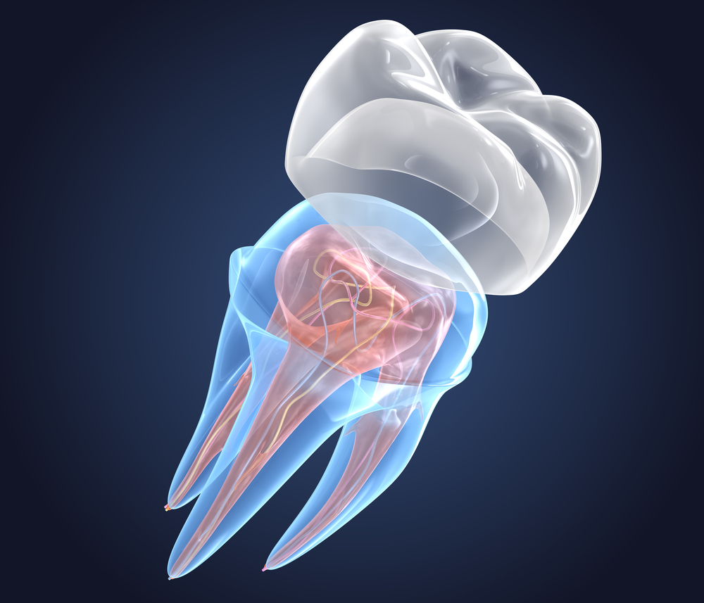 Cure Your Toothache with a Dental Cap - Chisholm Trail