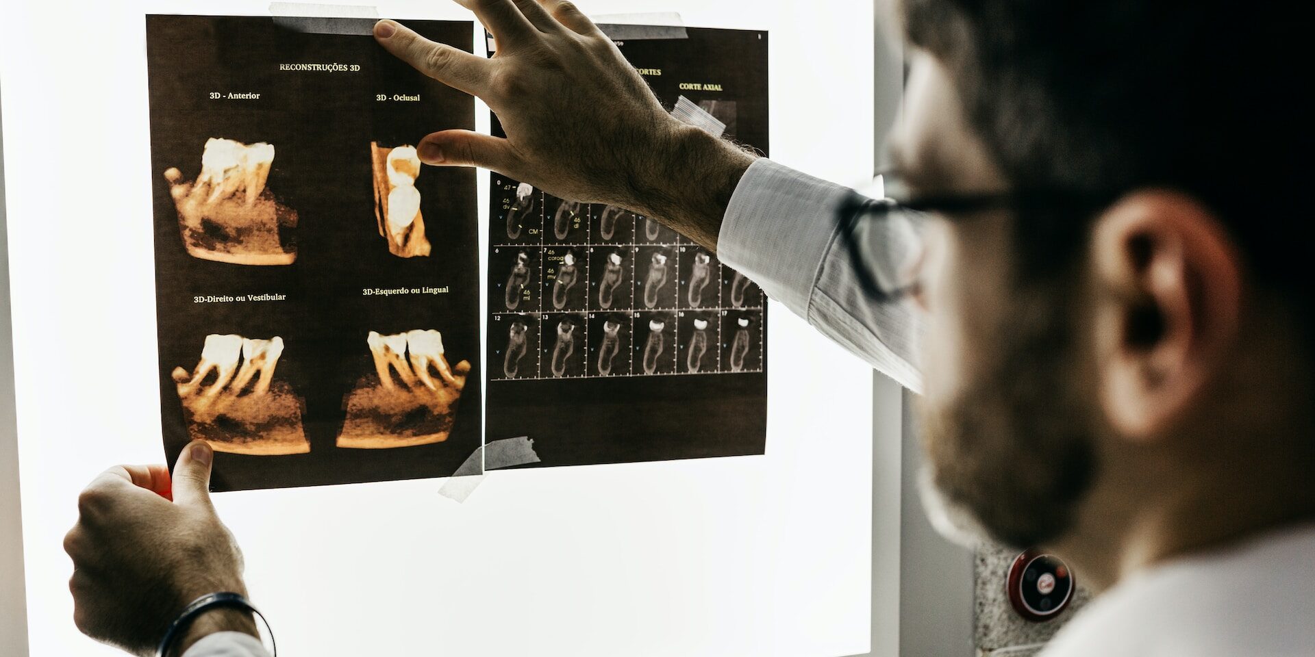 dentist looking at teeth x-rays