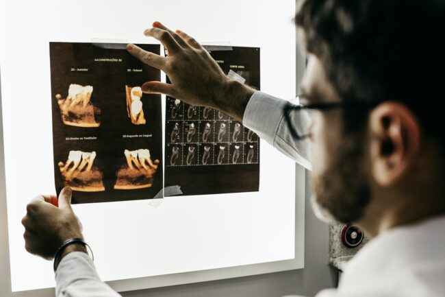 dentist looking at teeth x-rays