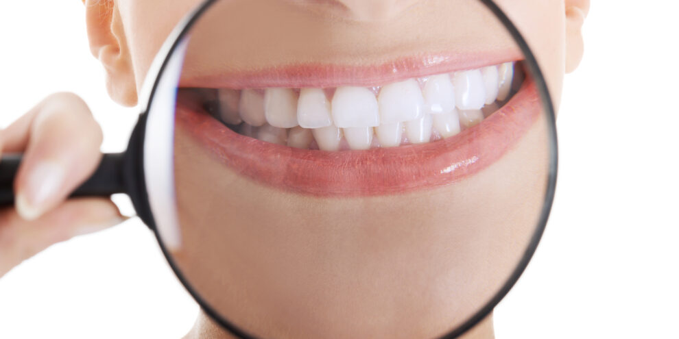 Beautiful woman with magnifying glass showing her perfect teeth after teeth whitening. Over white background.