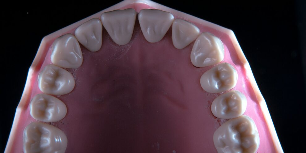Model of the lower teeth