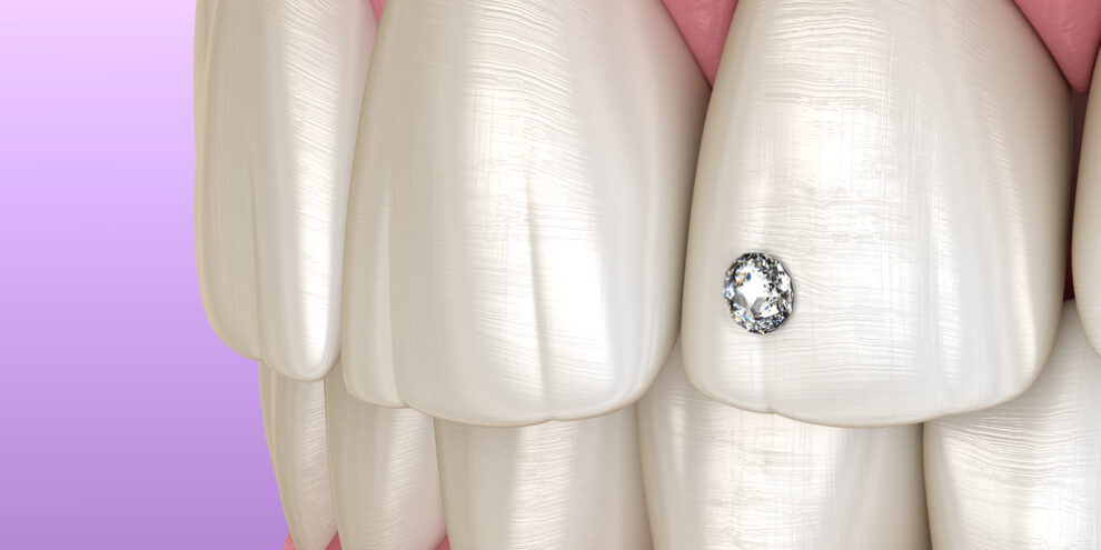 Tooth piercing by diamond, 3D illustration concept.