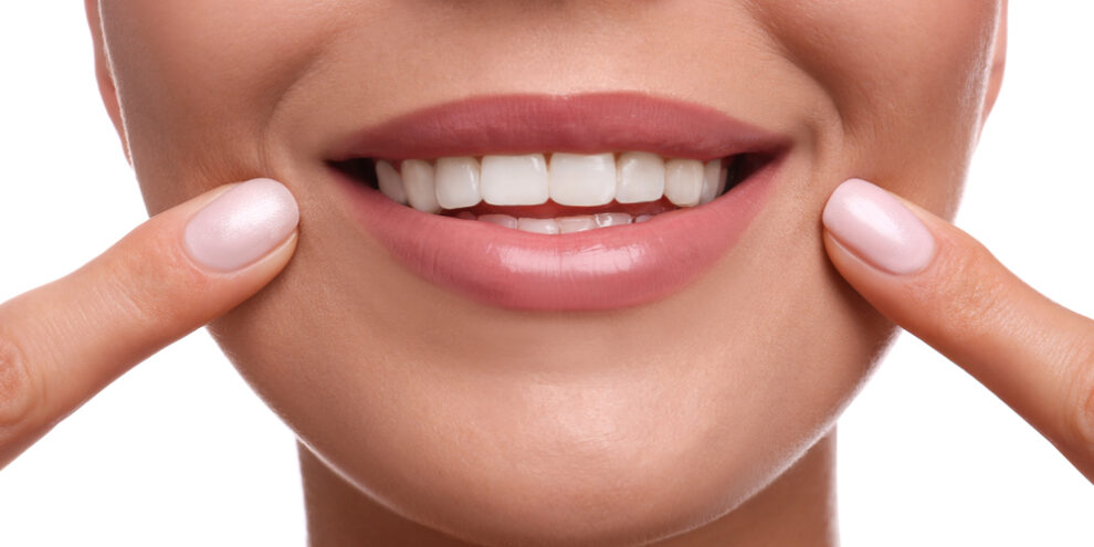 close up of woman's smile after cosmetic dentistry on white background