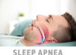 Illustration showing airway during obstructive sleep apnea
